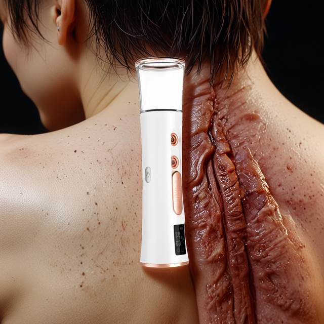 RAIREX NANO MIST SPRAYER