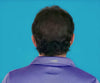 Hair Grow Max 2x1 a 248 LEU